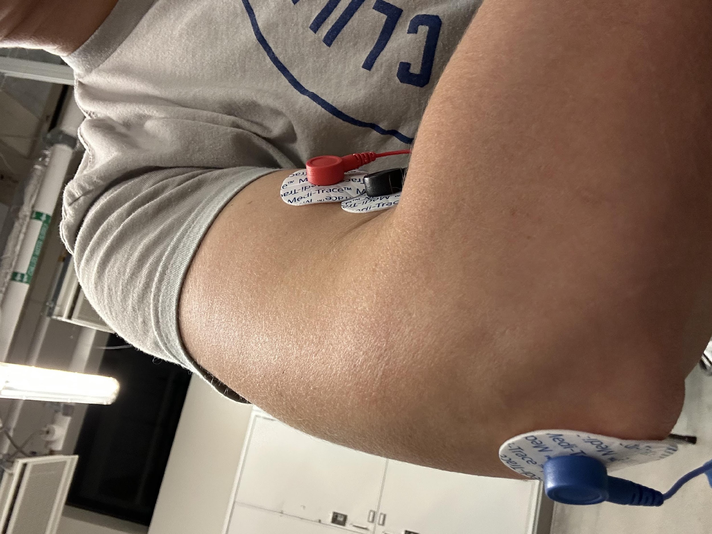 EMG electrode pad placement